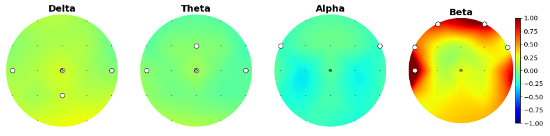 Sex differences on spectral power according to frequency bands