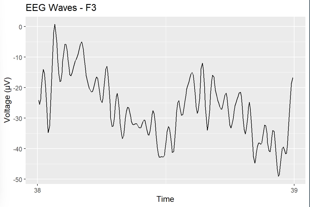 Filtered F3 Channel during 1 second epoch