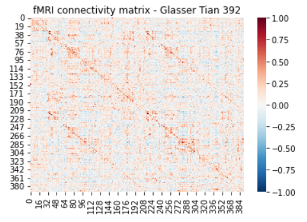 fMRI connectivity matrix for children with ADHD