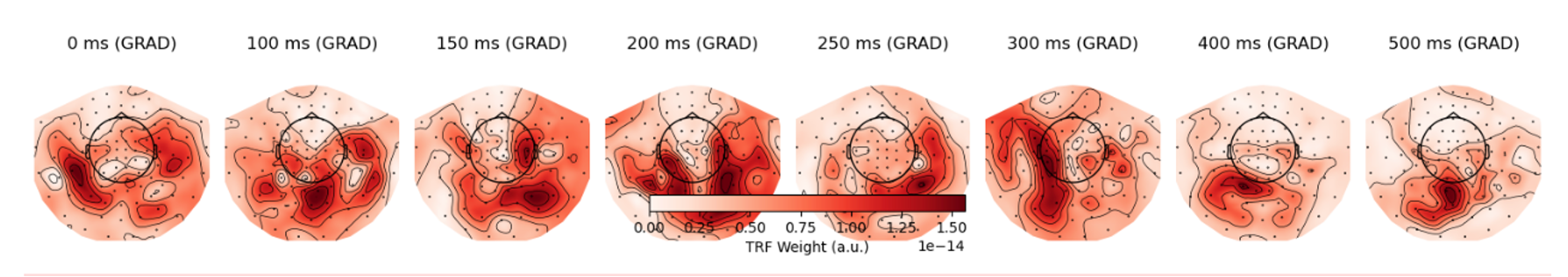 TRF GRAD Topomap