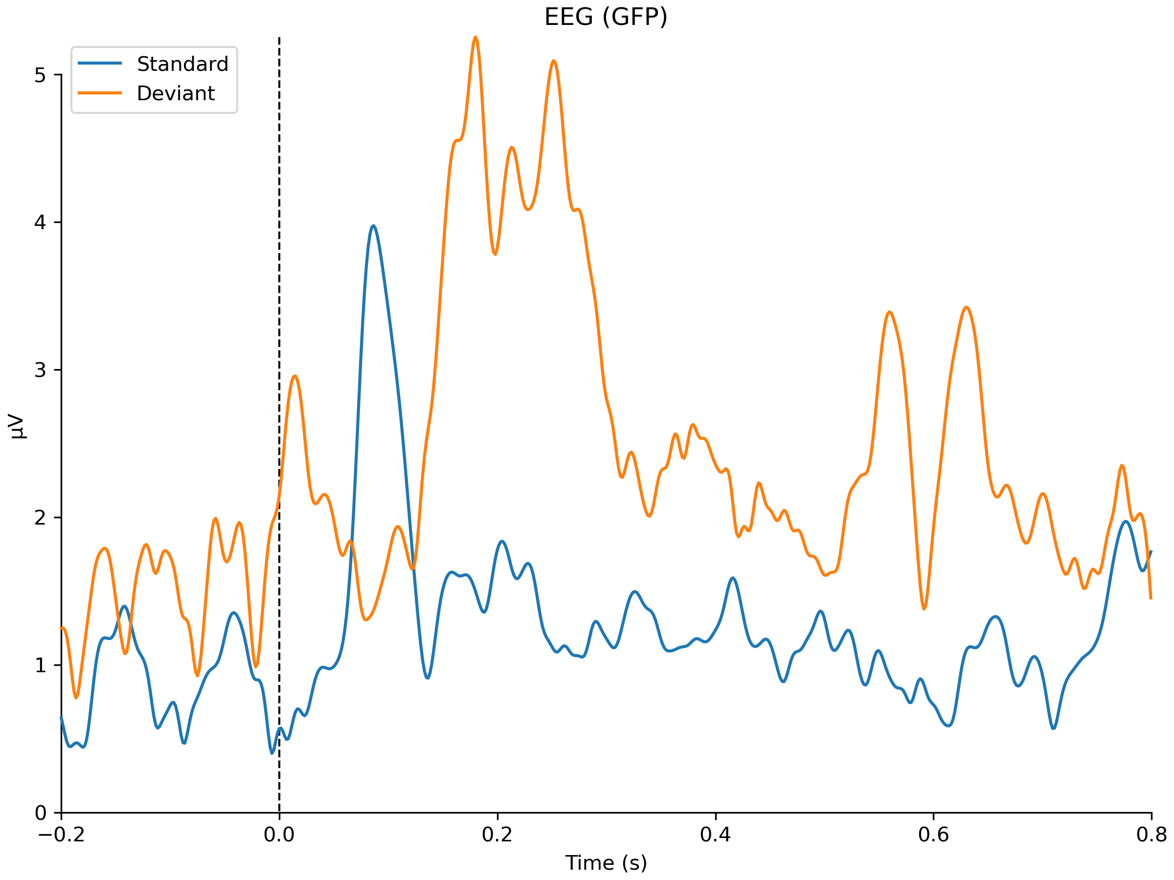ERP comparison