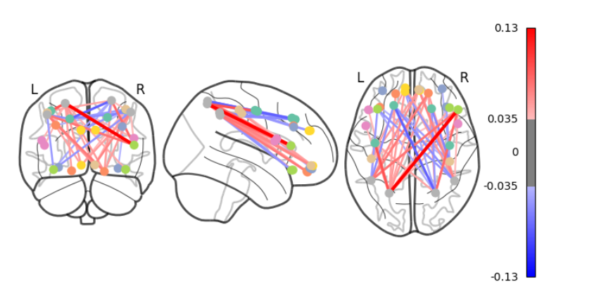 BrainAllDiff