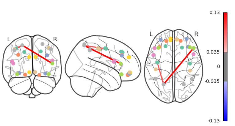 BrainSignDiff